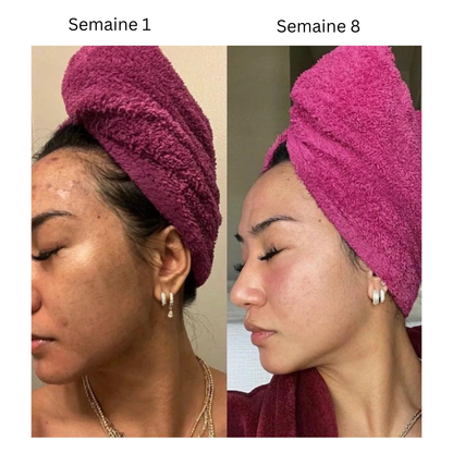 Soin au Curcuma Anti-Hyperpigmentation