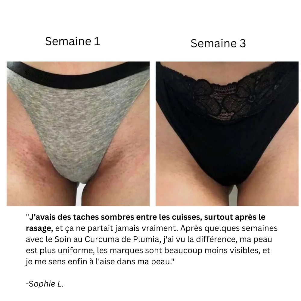Soin au Curcuma Anti-Hyperpigmentation