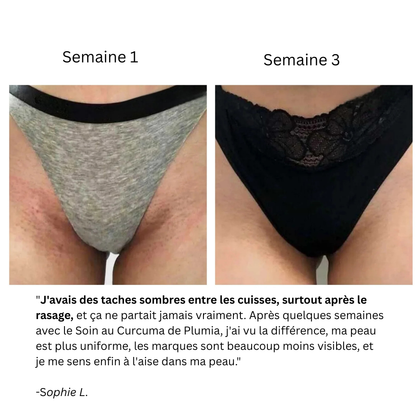 Soin au Curcuma Anti-Hyperpigmentation
