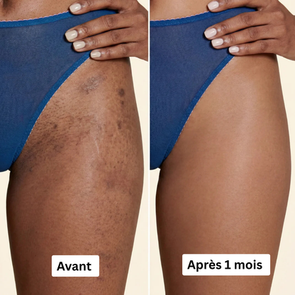 Soin au Curcuma Anti-Hyperpigmentation