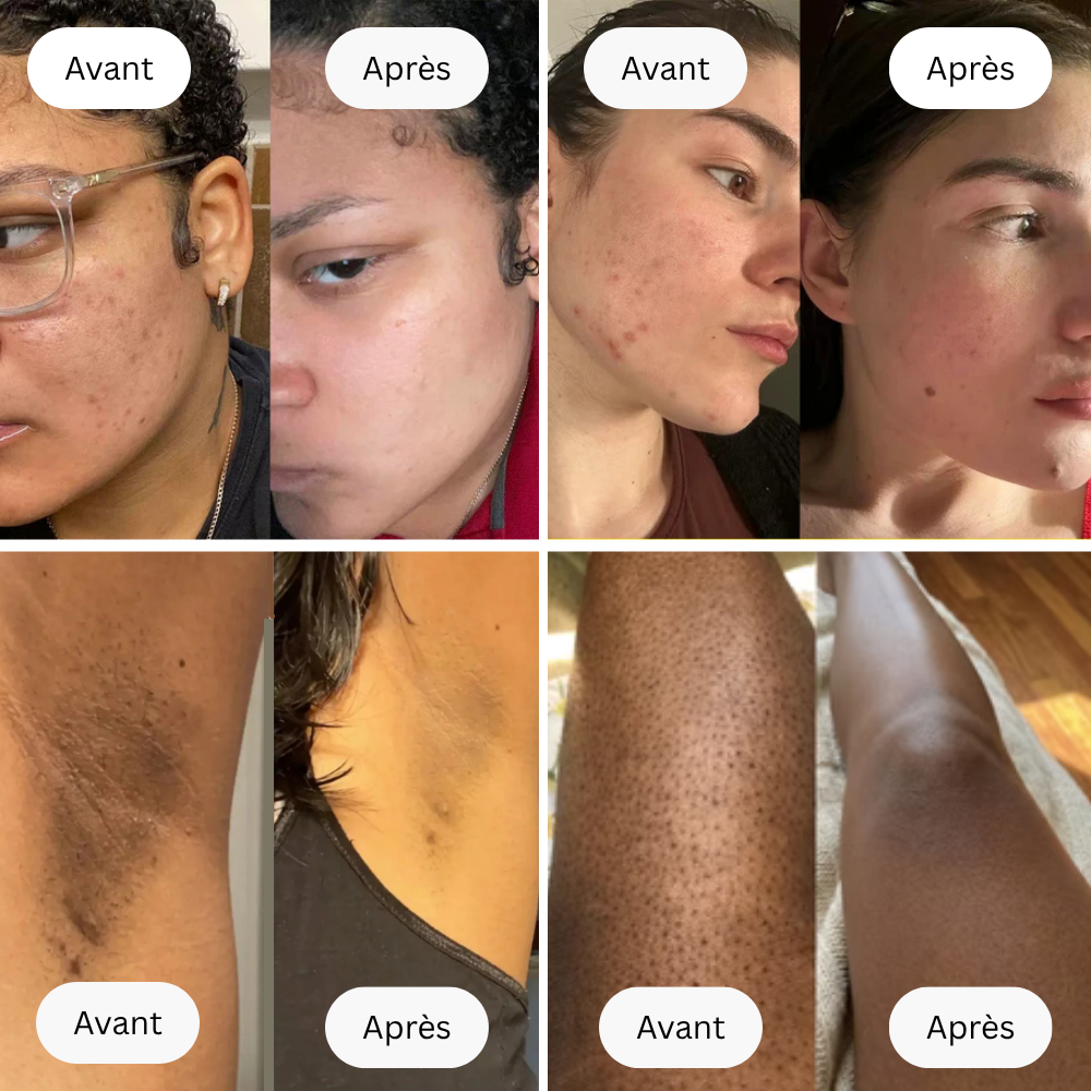 Soin au Curcuma Anti-Hyperpigmentation